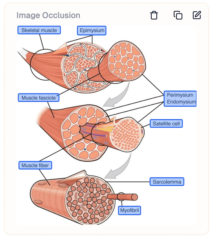 Image occlusion card showing muscle anatomy with labeled parts